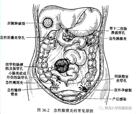 如何看一个人阳寿已尽年轻_如何看一个人阳寿已尽胃癌,第13张 如何看一个人阳寿已尽年轻_如何看一个人阳寿已尽胃癌,第13张