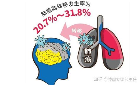 如何看一个人阳寿已尽年轻_如何看一个人阳寿已尽胃癌,第15张 如何看一个人阳寿已尽年轻_如何看一个人阳寿已尽胃癌,第15张