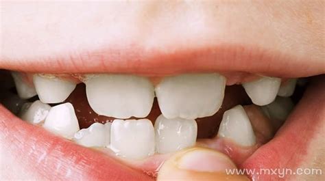 老是梦到牙齿掉了是什么意思_做梦老是梦到牙齿掉了是什么意思,第2张 老是梦到牙齿掉了是什么意思_做梦老是梦到牙齿掉了是什么意思,第2张