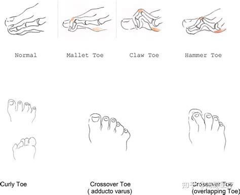 带天命的人特征_富贵天命的身体特征,第3张 带天命的人特征_富贵天命的身体特征,第3张