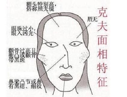 女人短命的十大征兆_女人短命的十大征兆眼睛无神,第14张